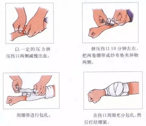 家庭急救指南，切割傷的止血與急救技巧